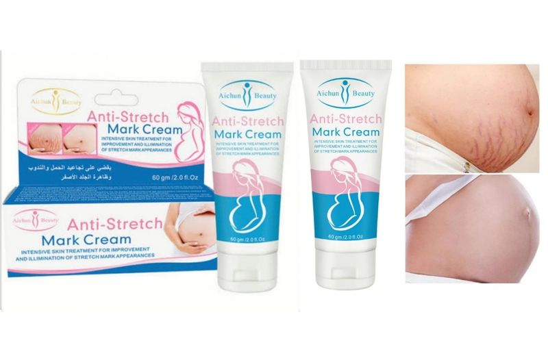 Pack of 2 Aichun Beauty Anti- Stretch Marks Cream ( 80 g each)