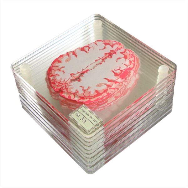 3D Organ Brain Artwork Brain Slices Acrylic Drinks Table Coaster